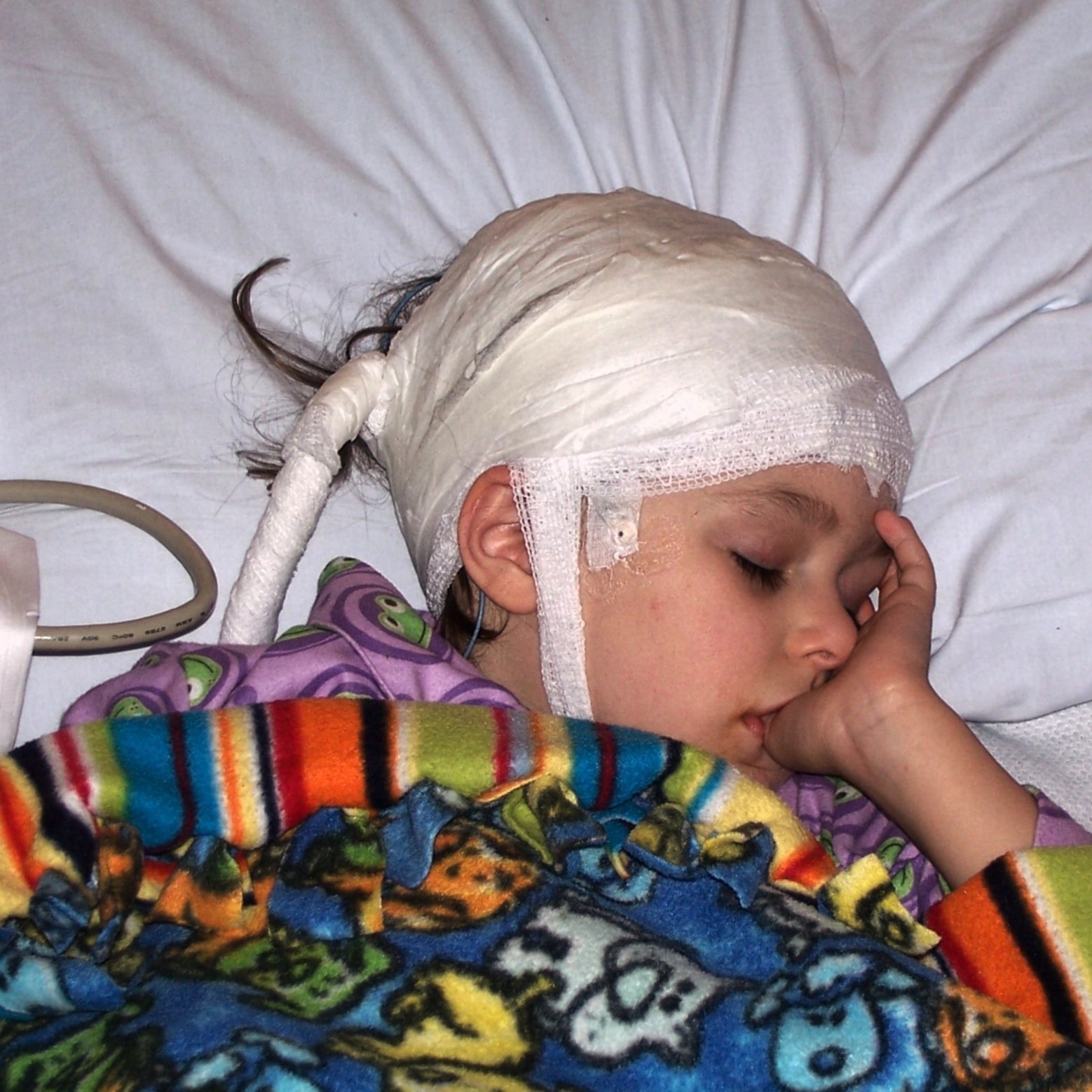 girl sucking thumb during eeg with head wrapped in white gauze