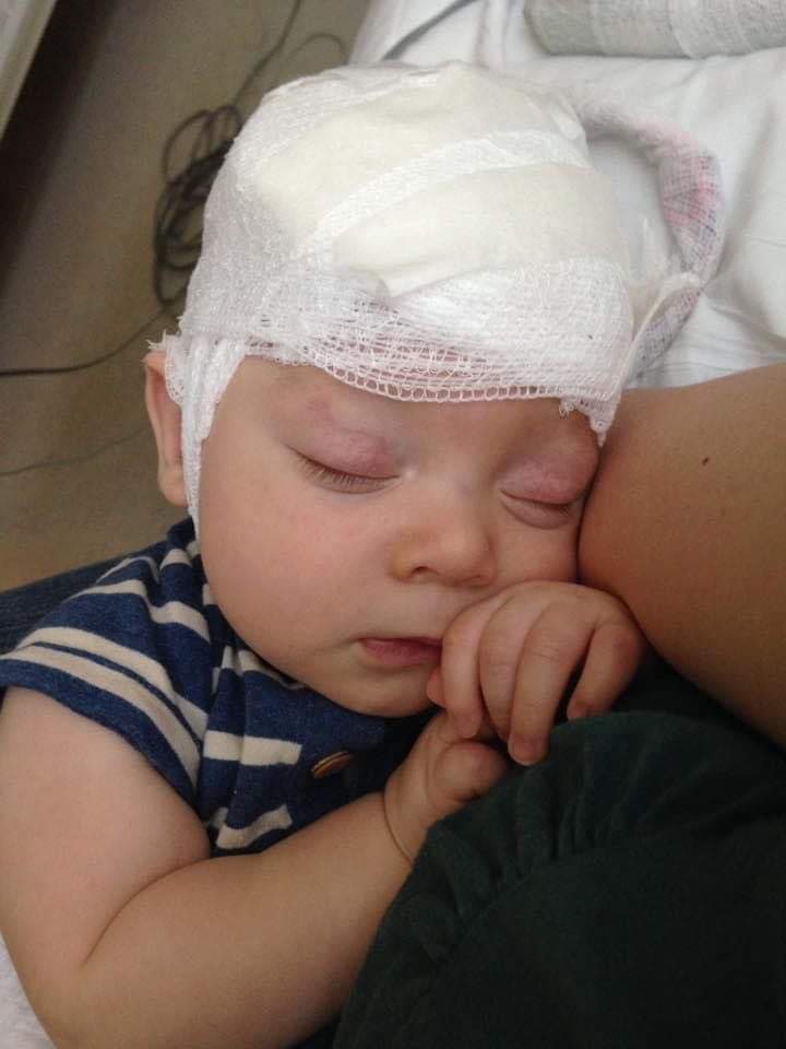 sleeping boy getting EEG with white gauze wrapped on his head